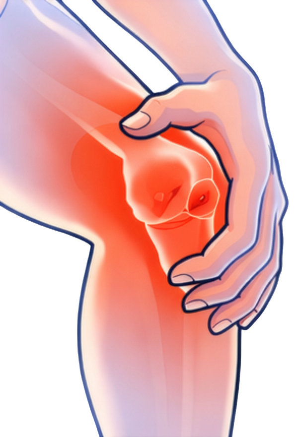 Joint and arthritis pain illustration